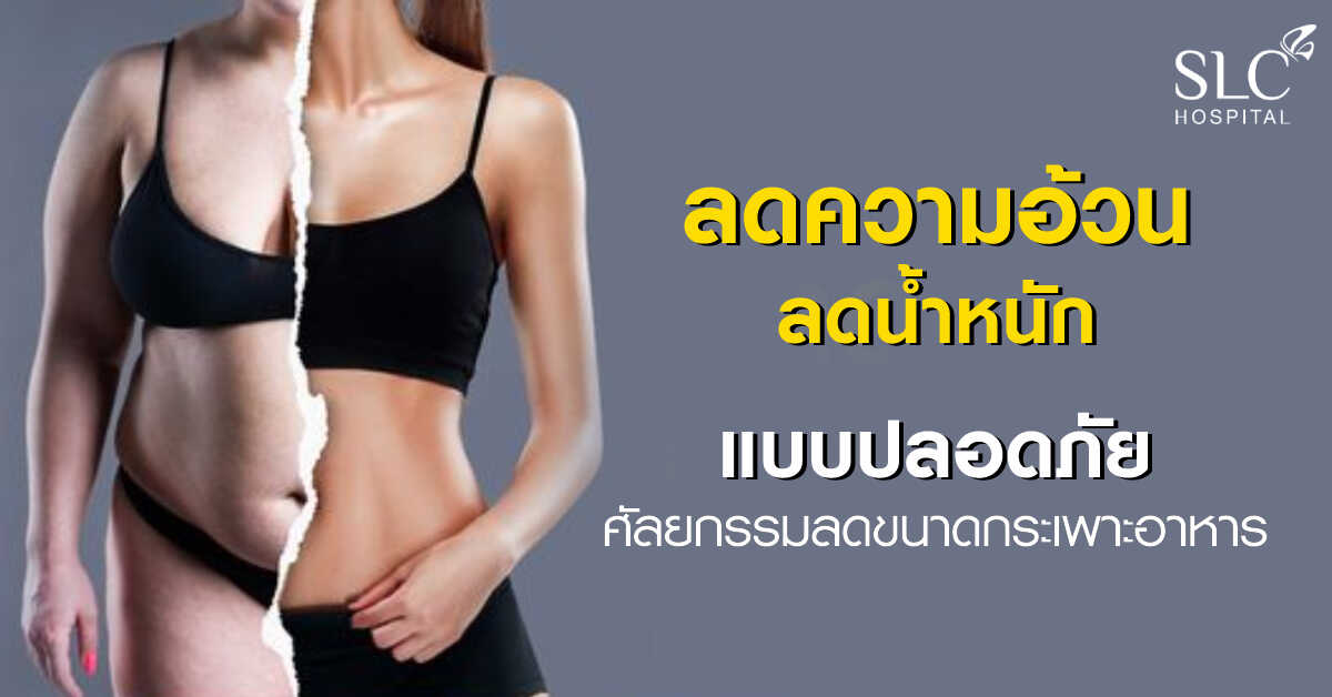 **Answers to all questions about stomach size reduction. by a specialized surgeon