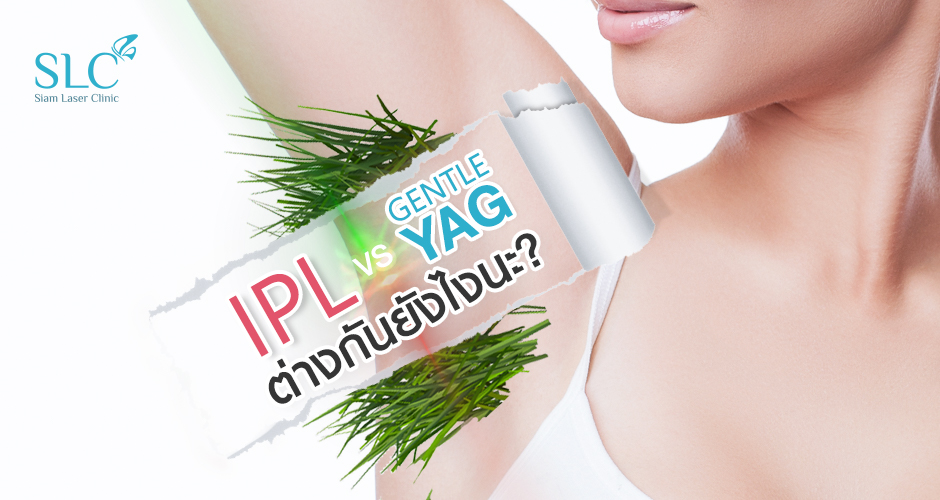 **Gentle YAG hair laser and IPL, how are they similar or different?