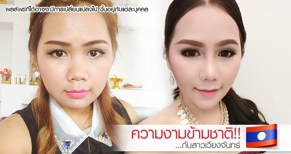 **Transnational beauty!! with Vientiane girl