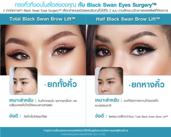 ทำตาหางหงส์ รีวิวตาหางหงส์ ยกหางตา ชั้นตาหลบใน ทำตาเฉี่ยว Black Swan Eyes Surgery™ ทำตาหางหงส์ที่ไหนดี ยกคิ้ว ทำตาสองชั้น แก้หางตาตก Foxy Eyes