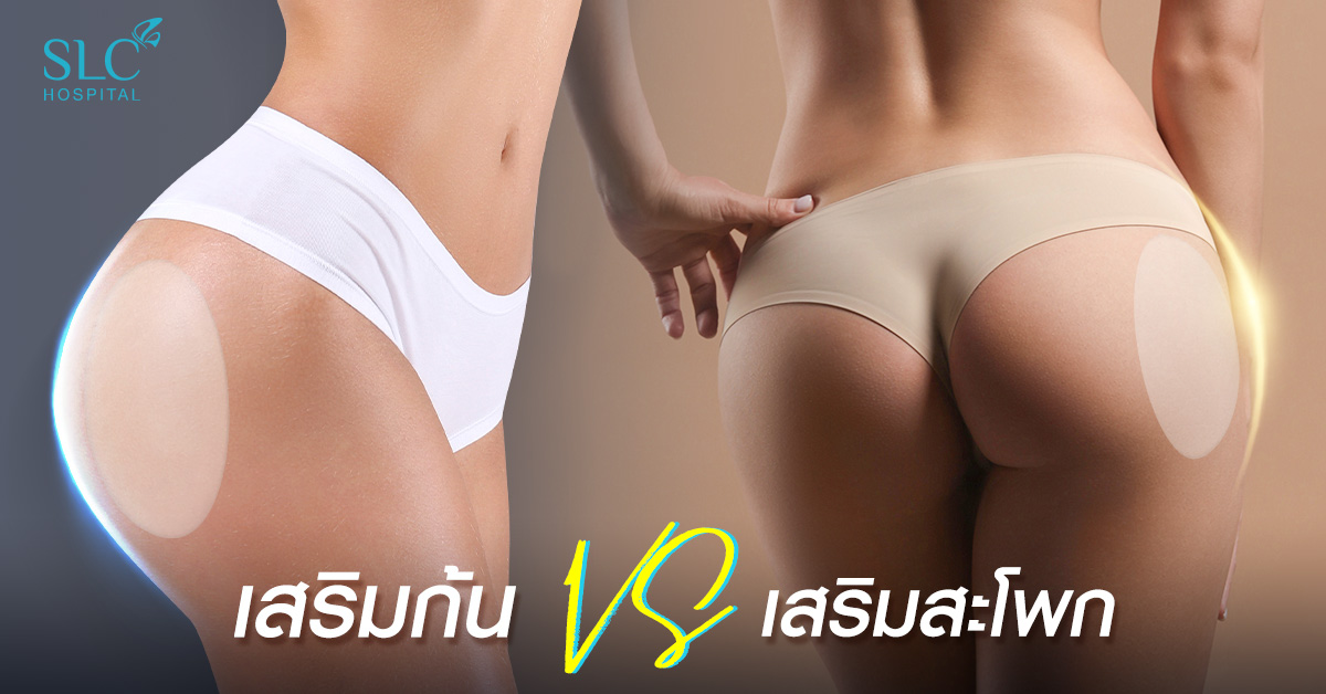 **Butt augmentation VS butt augmentation, which one is more beautiful to do?